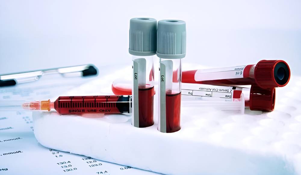 آزمایش خون برای تشخیص سکته قلبی