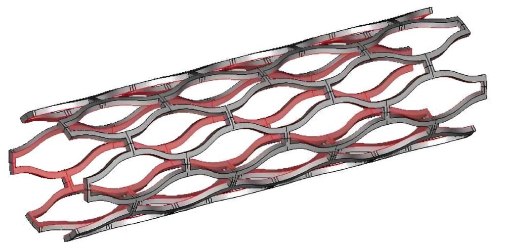 انواع استنت داخل عروق کرونری