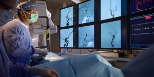 آنژیوگرافی از طریق کشاله ران