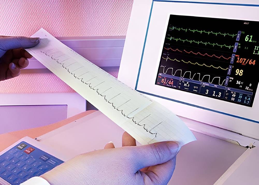 نوار قلب (ECG)