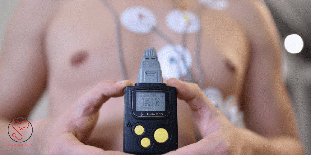 هولتر قلب چیست