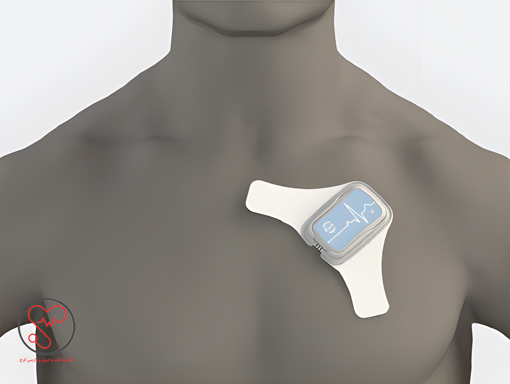 هولتر قلب بی‌سیم 