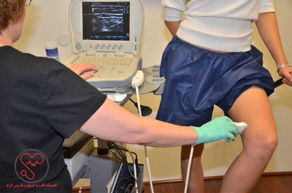 تشخیص شدت واریس