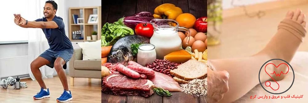 پیشگیری از واریس