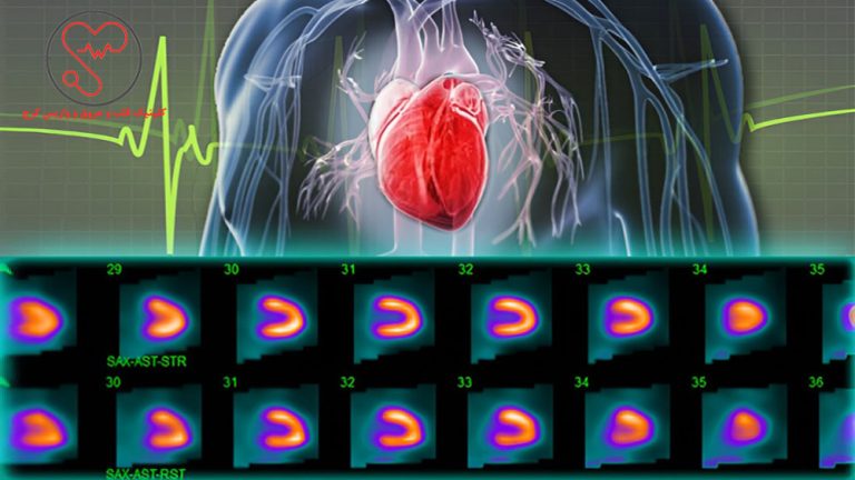 اسکن هسته‌ای قلب برای مشاهده دقیق عملکرد قلب